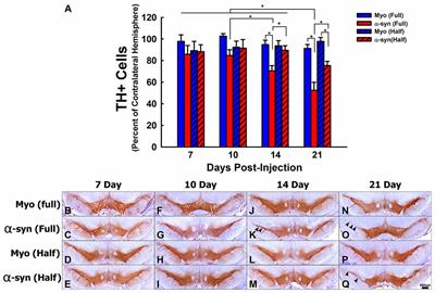 Silencing Alpha Synuclein in Mature Nigral Neurons Results in Rapid Neuroinflammation and Subsequent Toxicity